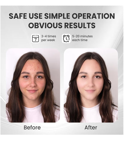 Masvoria 7-in-1 LED Facial Mask — Light Therapy for Every Skin Concern